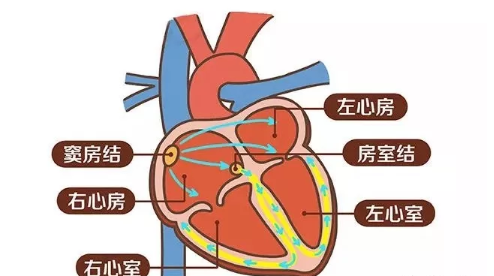 窦性心律不齐是什么意思