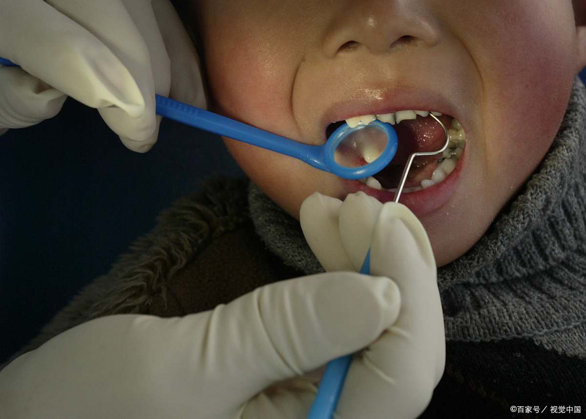 牙齿矫正的最佳年龄是哪个年龄段?