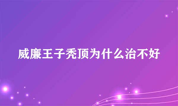 威廉王子秃顶为什么治不好