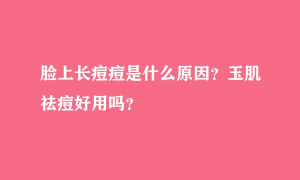 脸上长痘痘是什么原因？玉肌祛痘好用吗？