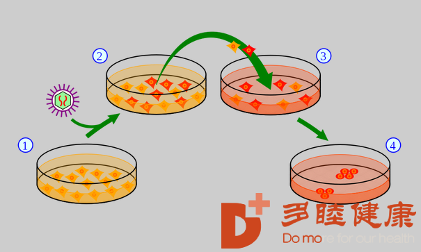 糖尿病用干细胞怎么治疗？