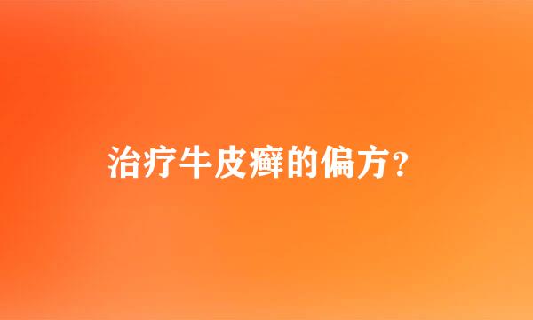 治疗牛皮癣的偏方？