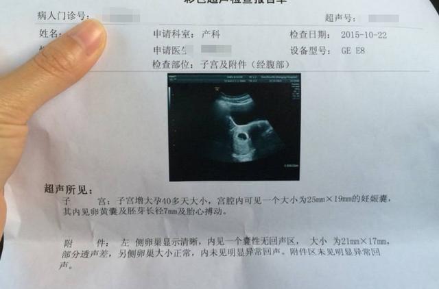 在孕妈的腹中，如何判断宝宝是“胚胎”还是“胎儿”？