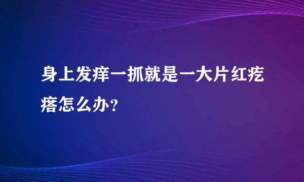 身上发痒一抓就是一大片红疙瘩怎么办？