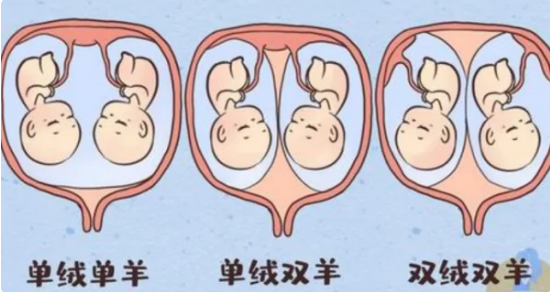 单绒单羊和单绒双羊的区别是什么?