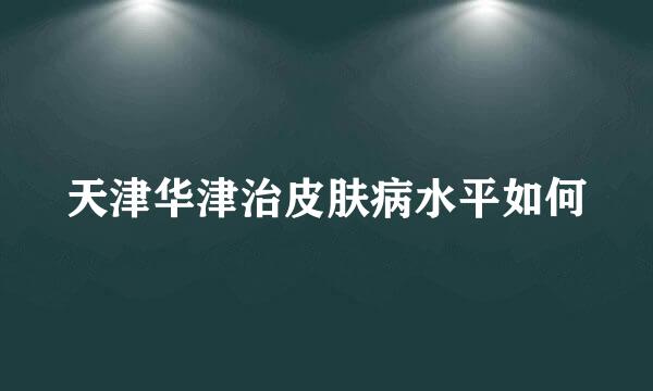 天津华津治皮肤病水平如何