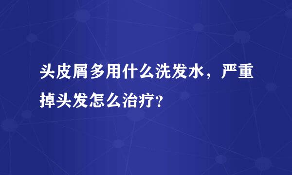 头皮屑多用什么洗发水，严重掉头发怎么治疗？