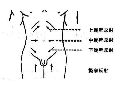 腹壁反射的临床意义