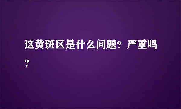 这黄斑区是什么问题？严重吗？