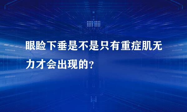 眼睑下垂是不是只有重症肌无力才会出现的？