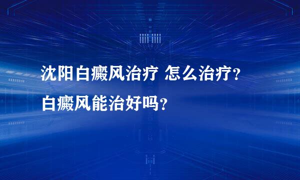 沈阳白癜风治疗 怎么治疗？白癜风能治好吗？