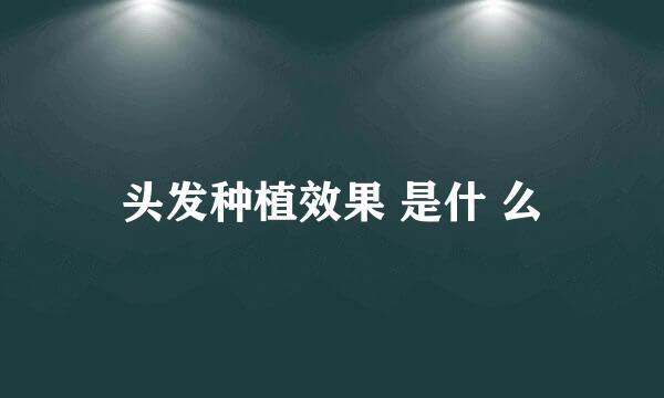 头发种植效果 是什 么