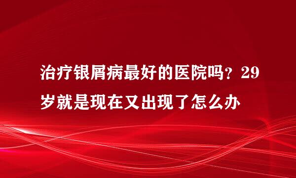 治疗银屑病最好的医院吗？29岁就是现在又出现了怎么办