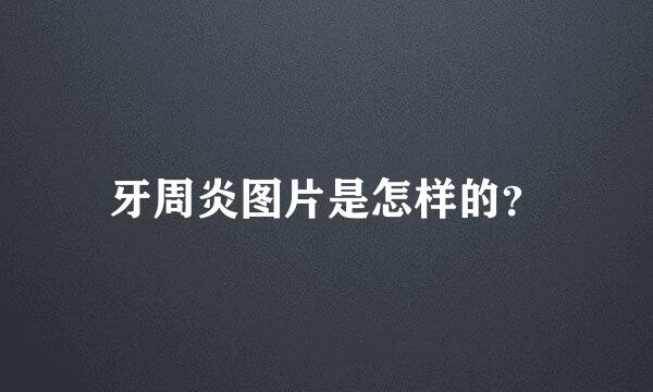 牙周炎图片是怎样的？