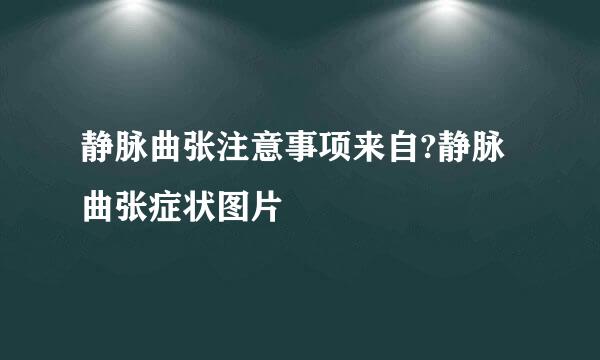 静脉曲张注意事项来自?静脉曲张症状图片