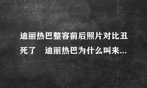 迪丽热巴整容前后照片对比丑死了 迪丽热巴为什么叫来自胖迪原因