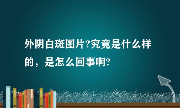 外阴白斑图片?究竟是什么样的，是怎么回事啊?