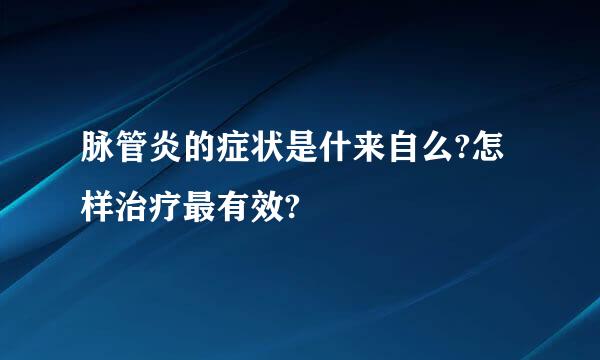 脉管炎的症状是什来自么?怎样治疗最有效?