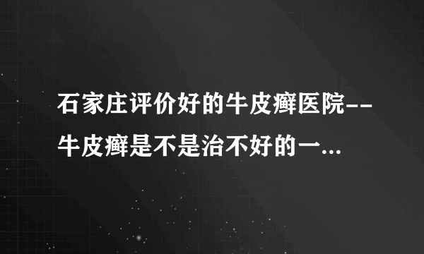 石家庄评价好的牛皮癣医院--牛皮癣是不是治不好的一种病吗？