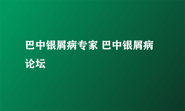 巴中银屑病专家 巴中银屑病论坛