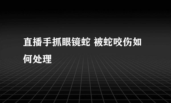 直播手抓眼镜蛇 被蛇咬伤如何处理