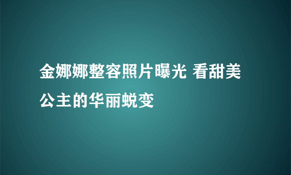 金娜娜整容照片曝光 看甜美公主的华丽蜕变