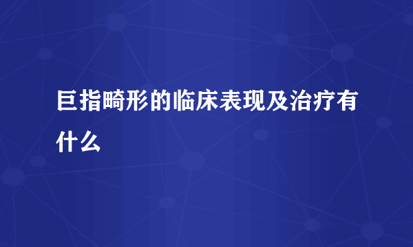 巨指畸形的临床表现及治疗有什么