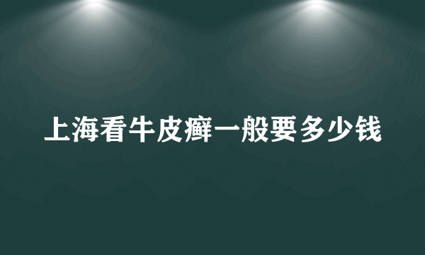 上海看牛皮癣一般要多少钱