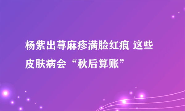 杨紫出荨麻疹满脸红痕 这些皮肤病会“秋后算账”