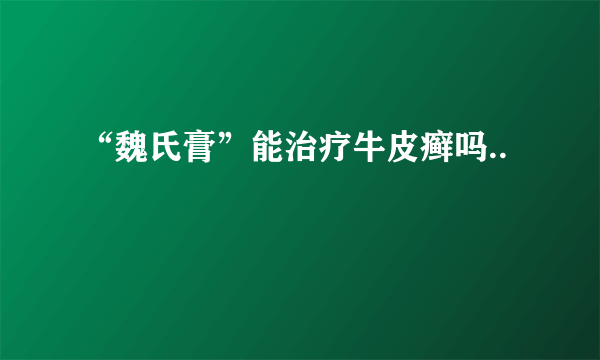 “魏氏膏”能治疗牛皮癣吗..