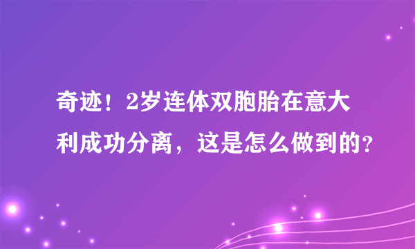 奇迹！2岁连体双胞胎在意大利成功分离，这是怎么做到的？