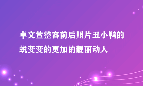 卓文萱整容前后照片丑小鸭的蜕变变的更加的靓丽动人