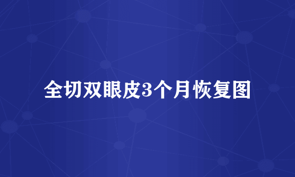 全切双眼皮3个月恢复图