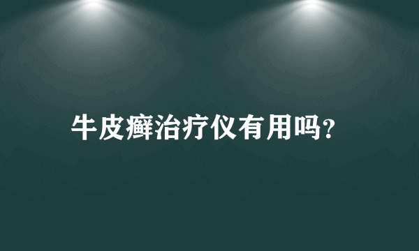 牛皮癣治疗仪有用吗？