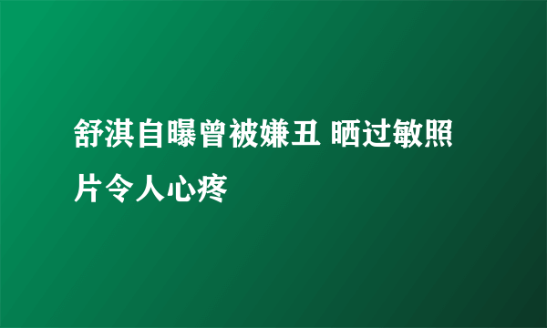 舒淇自曝曾被嫌丑 晒过敏照片令人心疼