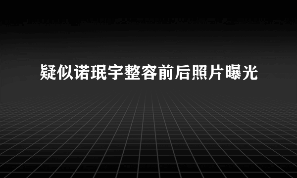 疑似诺珉宇整容前后照片曝光