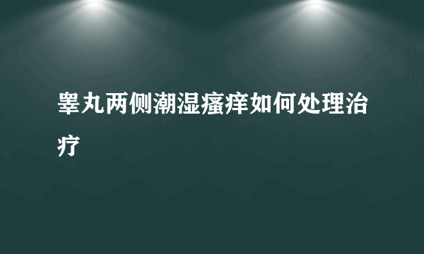 睾丸两侧潮湿瘙痒如何处理治疗