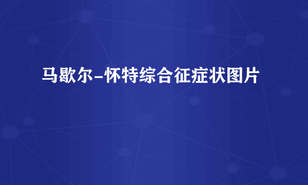 马歇尔-怀特综合征症状图片