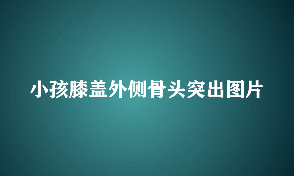 小孩膝盖外侧骨头突出图片