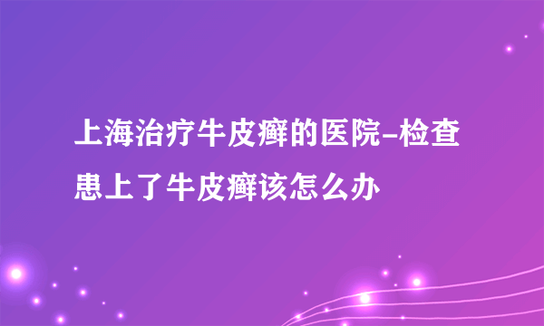 上海治疗牛皮癣的医院-检查患上了牛皮癣该怎么办