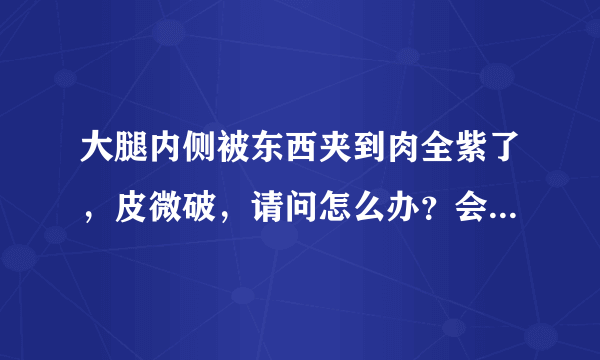 大腿内侧被东西夹到肉全紫了，皮微破，请问怎么办？会...