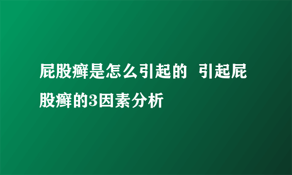 屁股癣是怎么引起的  引起屁股癣的3因素分析