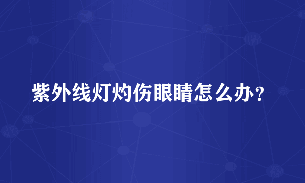 紫外线灯灼伤眼睛怎么办？