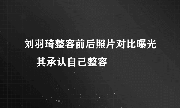 刘羽琦整容前后照片对比曝光    其承认自己整容