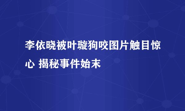 李依晓被叶璇狗咬图片触目惊心 揭秘事件始末