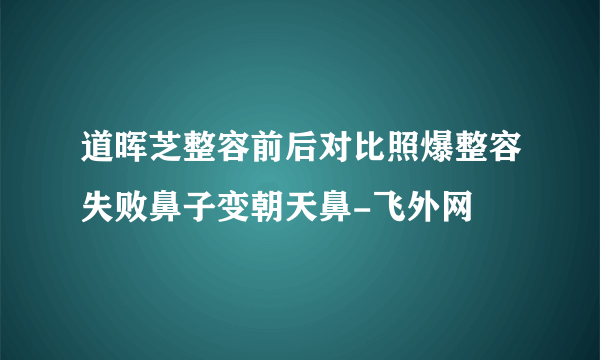 道晖芝整容前后对比照爆整容失败鼻子变朝天鼻-飞外网