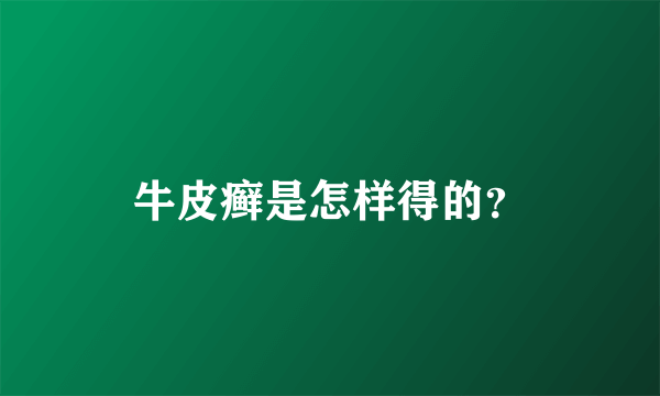 牛皮癣是怎样得的？